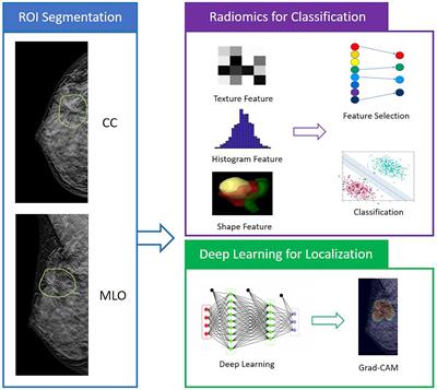 Diagnosis of architectural distortion on digital breast tomosynthesis using radiomics and deep learning